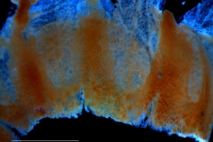 infrastaminal scales