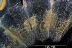 infrastaminal scales