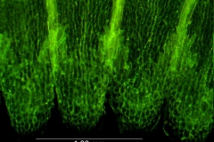 infrastaminal scales