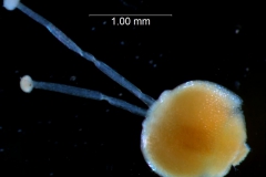 gynoecium