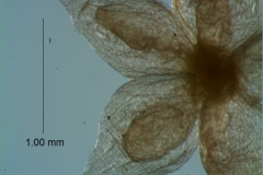 calyx, dissected, dorsal  (detail)