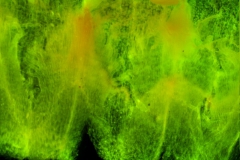 infrastaminal scales