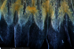 infrastaminal scales