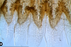 infrastaminal scales