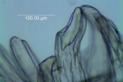 Cuscuta legitima; infrastaminal scale detail
