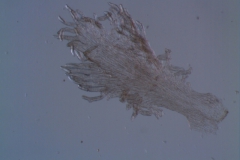 Cuscuta legitima; infrastaminal scale