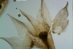 Cuscuta legitima; calyx, dissected
