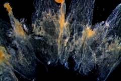 infrastaminal scales