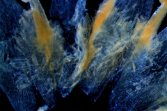 infrastaminal scales