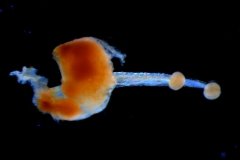 gynoecium