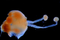 gynoecium