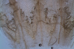 infrastaminal scales