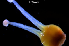 gynoecium