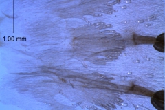 infrastaminal scales