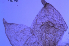 calyx lobes