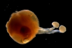 gynoecium