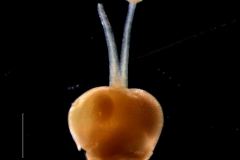 gynoecium