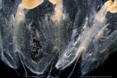 infrastaminal scales