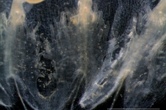 infrastaminal scales