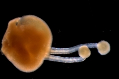 gynoecium