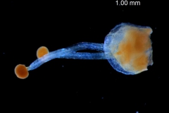 gynoecium