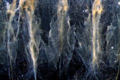 infrastaminal scales