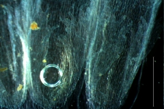 infrastaminal scales