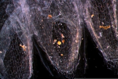 infrastaminal scales