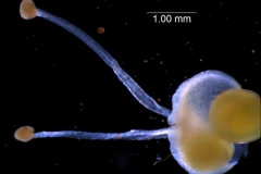 gynoecium