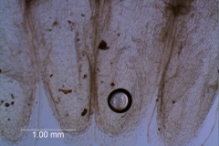 infrastaminal scales