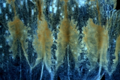 infrastaminal scales