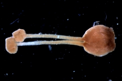 gynoecium
