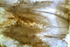 infrastaminal scales