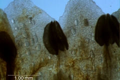 corolla lobes & stamens