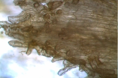 infrastaminal scales - detail