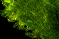 infrastaminal scales - detail