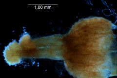 gynoecium