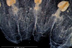 infrastaminal scales