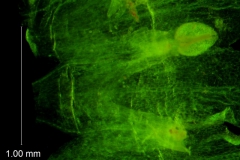 infrastaminal scales