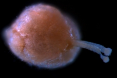 gynoecium