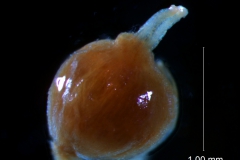 gynoecium