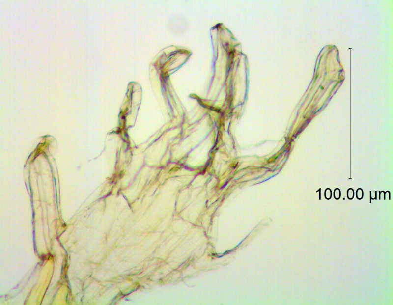 infrastaminal scales