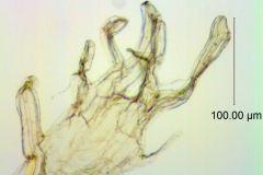 infrastaminal scales