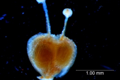 gynoecium