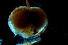 capsule (dehiscent)