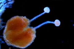 gynoecium