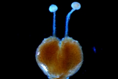 gynoecium