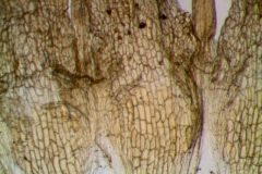 infrastaminal scales