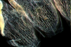 infrastaminal scales