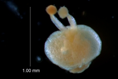 gynoecium